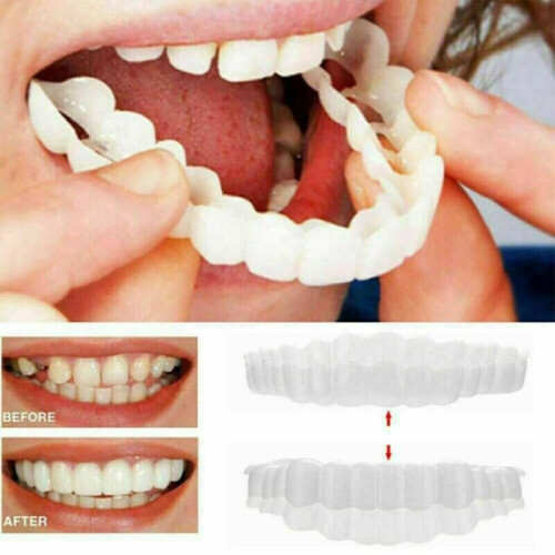 Smile Snap On Upper False Teeth Dental Veneers Dentures Tooth Cover Set