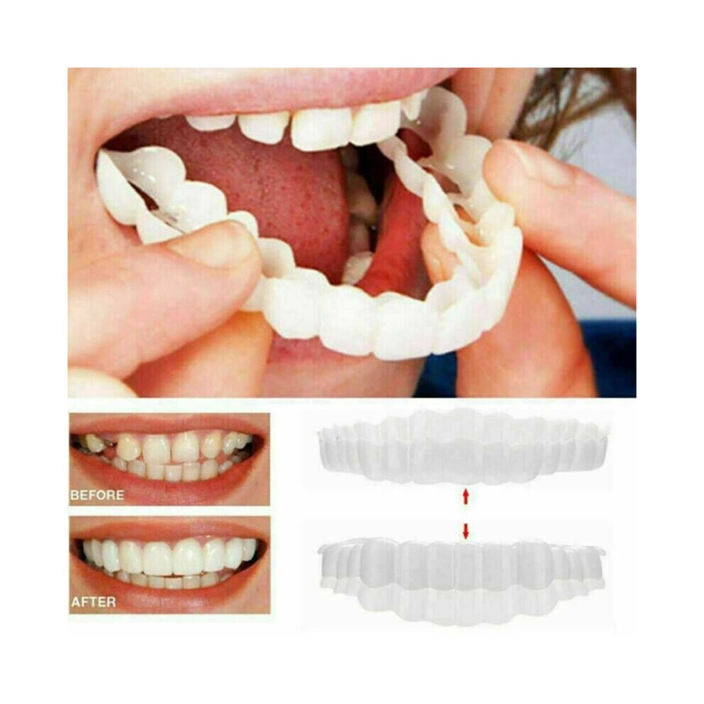 Smile Snap On Top and Bottom Veneers Dentures False Teeth Dental Tooth Cover