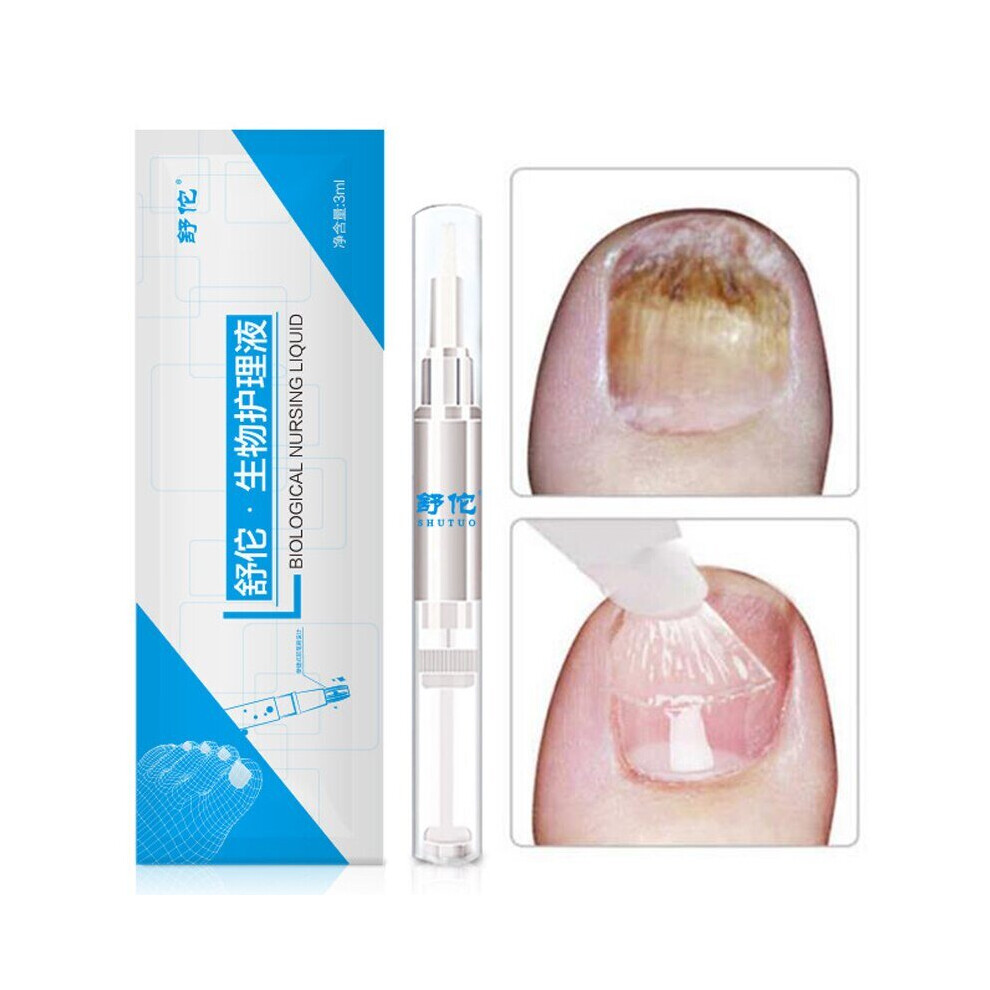 Lahdek 3Ml Fungal Nail Treatment Pen Onychomycosis Paronychia Anti Fungal Nail Liquid