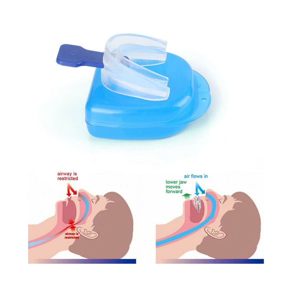 Wt Anti Snore Stop Snoring Tongue Mouth Good Night Sleep Aid Apnea