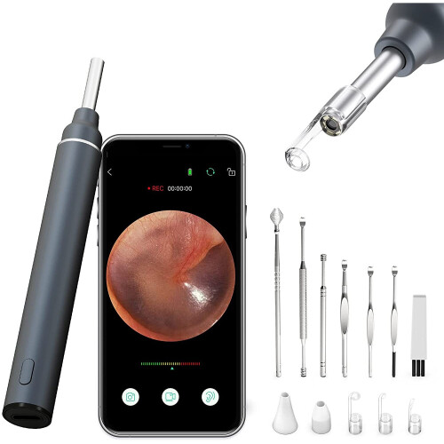 VITCOCO Otoscope Ear Camera 3.0mm UltraThin Otoscope with 5MP HD Ear