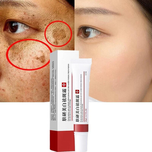 (Type) Pigmentation Moisturizing Gel Skin Care