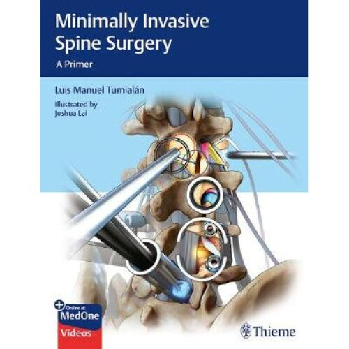 Minimally Invasive Spine Surgery A Primer