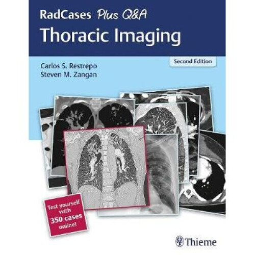 RadCases Plus Q&A Thoracic Imaging