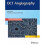 OCT Angiography 1