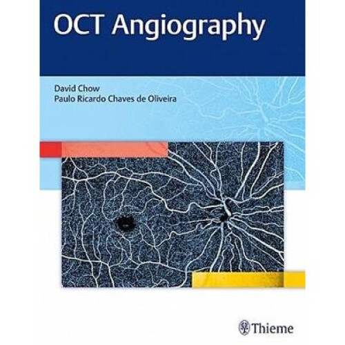 OCT Angiography