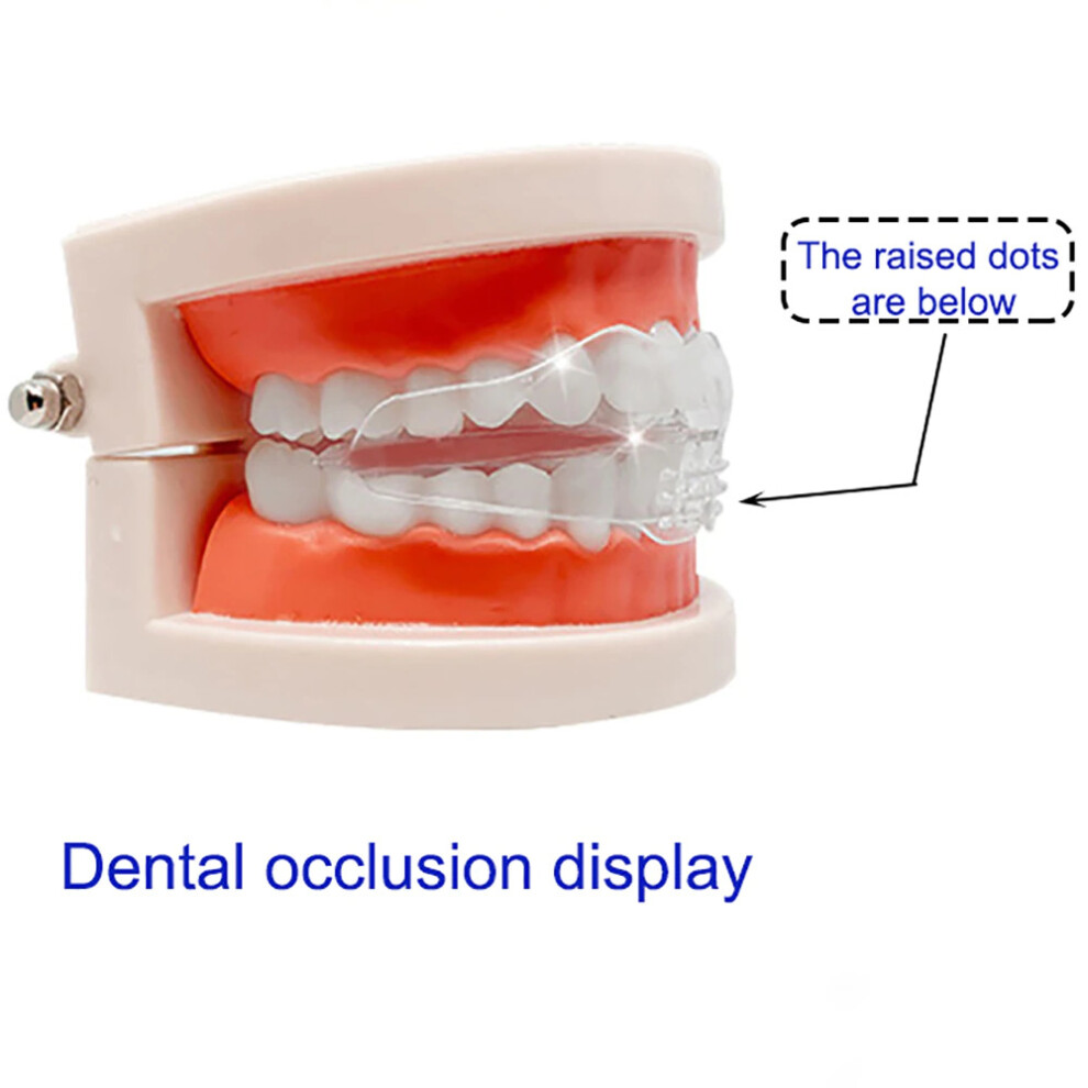 Options for Adult Invisible Braces - Trophy Smile Studio Trophy