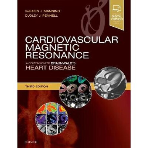 Cardiovascular Magnetic Resonance