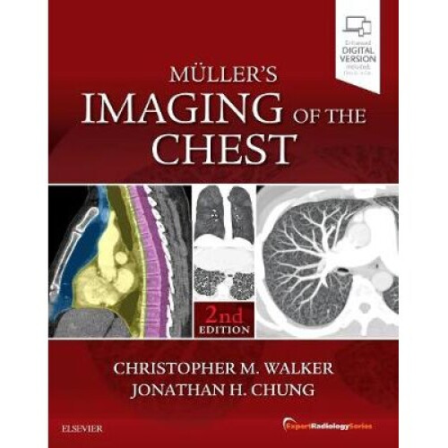 Muller's Imaging of the Chest