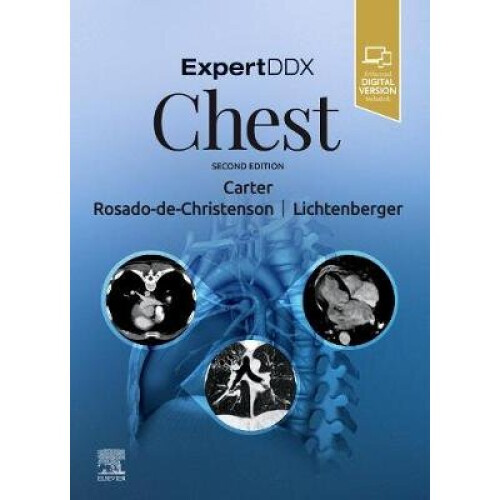 ExpertDDx: Chest