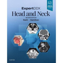 ExpertDDX: Head and Neck