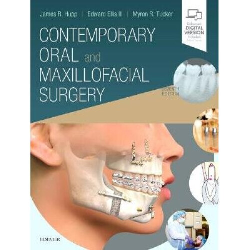 Contemporary Oral and Maxillofacial Surgery, 7e