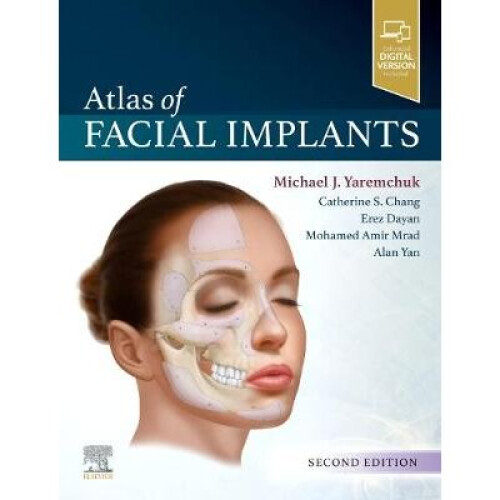 Atlas of Facial Implants