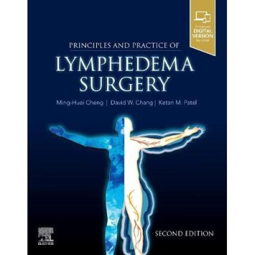 Principles and Practice of Lymphedema Surgery