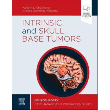 Intrinsic and Skull Base Tumors Neurosurgery Case Management Comparison Series