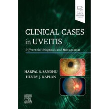 Clinical Cases in Uveitis Differential Diagnosis and Management
