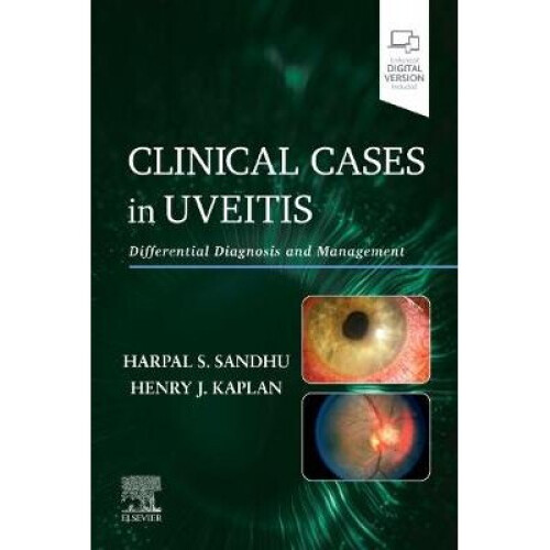Clinical Cases in Uveitis Differential Diagnosis and Management