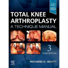 Total Knee Arthroplasty