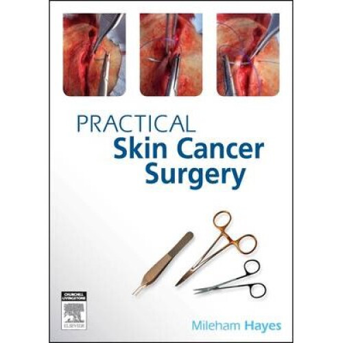 Practical Skin Cancer Surgery