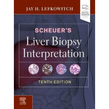 Scheuer's Liver Biopsy Interpretation