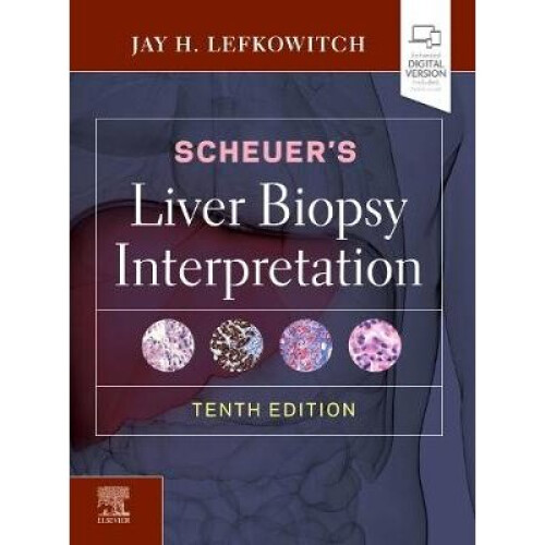Scheuer's Liver Biopsy Interpretation