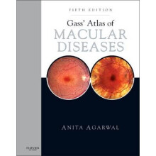 Gass' Atlas of Macular Diseases