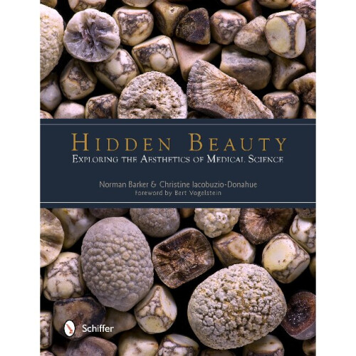 Hidden Beauty