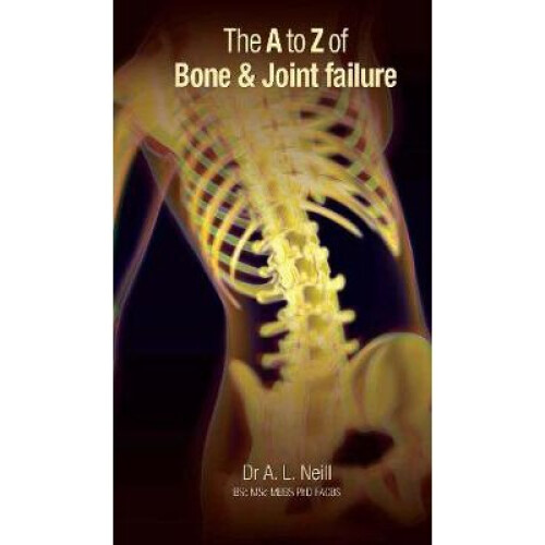 The A to Z of Bone and Joint Failure