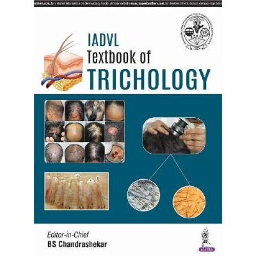 IADVL Textbook of Trichology
