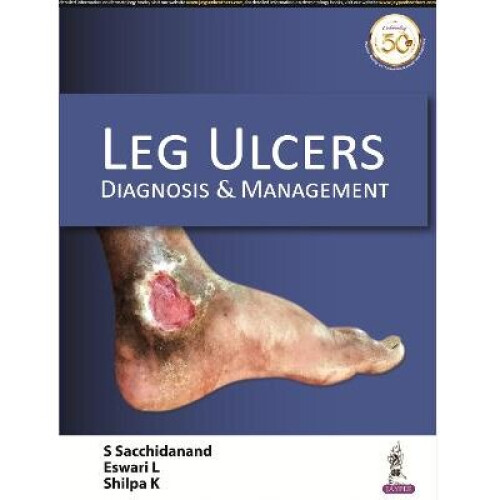 Leg Ulcers Diagnosis and Management