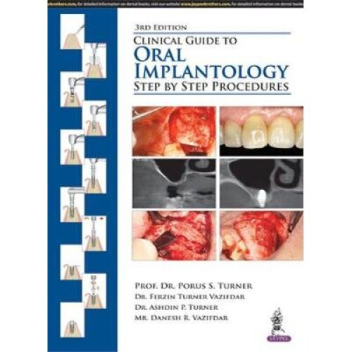 Clinical Guide to Oral Implantology