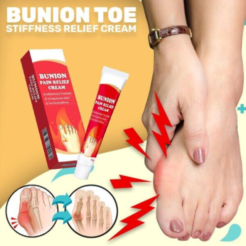 Bunion Toe Stiffness Relief Cream 1