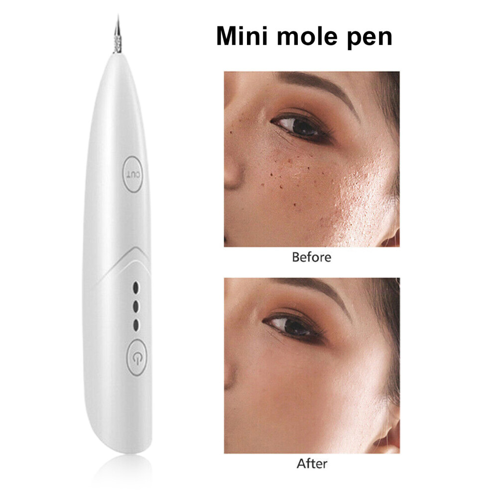 1 Set Skin Tag Remover Laser Plasma Multi-functional Portable Dark Spot Remover Tool Pen Beauty Equipment