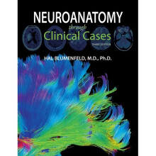 Neuroanatomy Through Clinical Cases