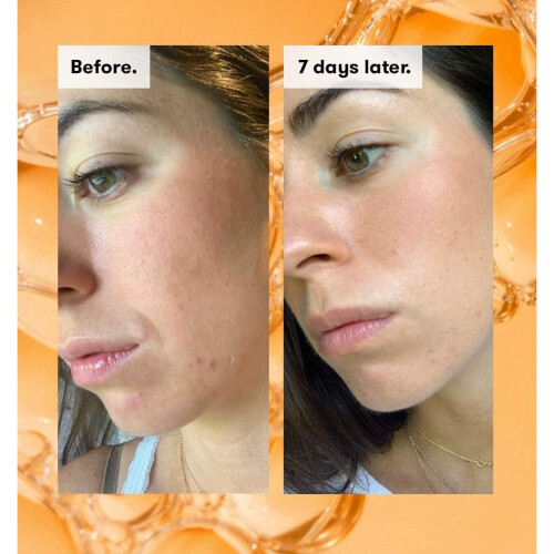 REN Ready Steady Glow Daily AHA Tonic 2