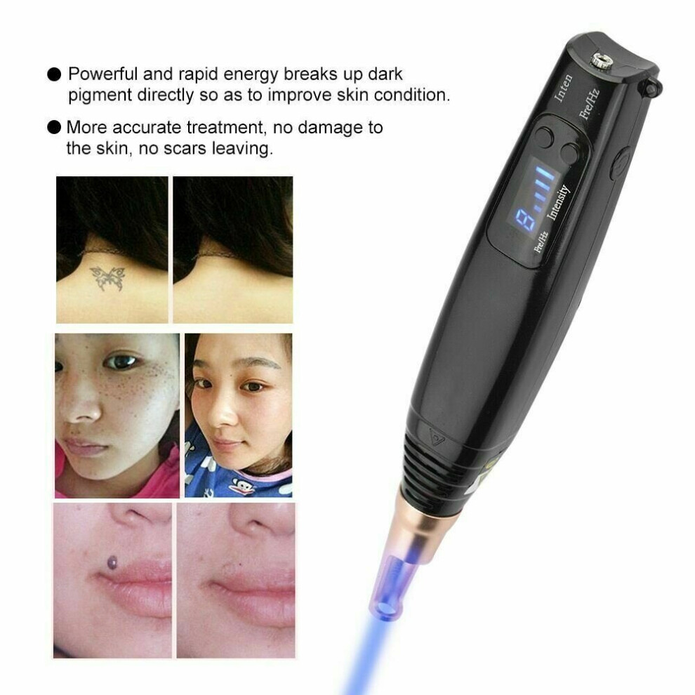Wt Blue/Light Picosecond Pen Laser Pico Pulse Therapy Beauty Remove Scar Spot Tattoo