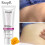 40g RtoprR Mango Pregnancy Stretch Scars Marks Remove Cream 3