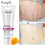 40g RtoprR Mango Pregnancy Stretch Scars Marks Remove Cream 1