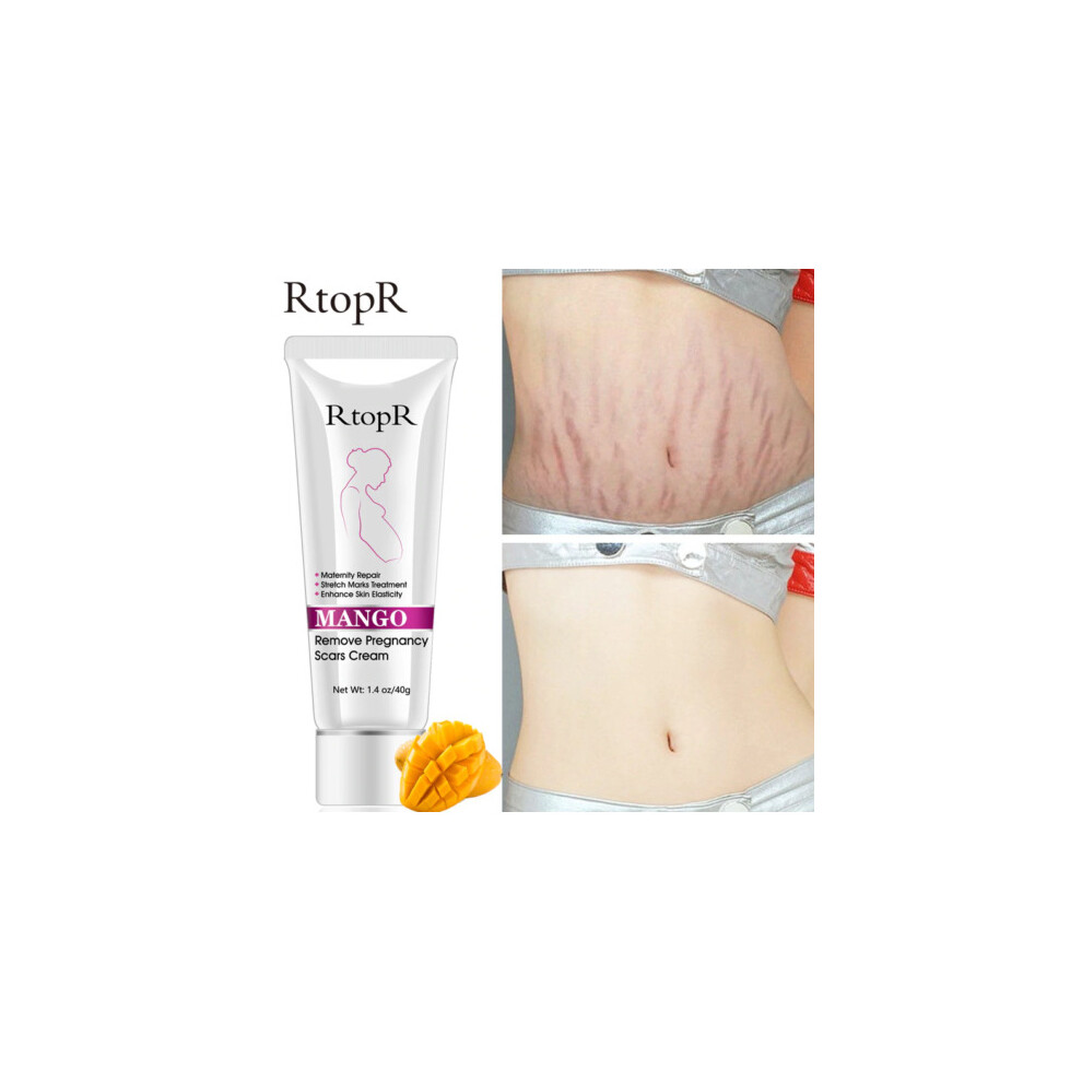 Cream 40G Rtoprr Mango Pregnancy Stretch Scars Marks Remove