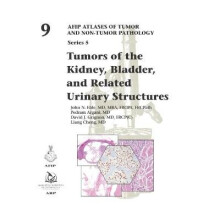 Tumors of the Kidney, Bladder, and Related Urinary Structures