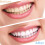 Snap On Top και Bottom Veneers Οδοντοστοιχίες Ψεύτικα δόντια Κάλυψη οδοντικών δοντιών 8