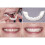 Snap On Top και Bottom Veneers Οδοντοστοιχίες Ψεύτικα δόντια Κάλυψη οδοντικών δοντιών 3