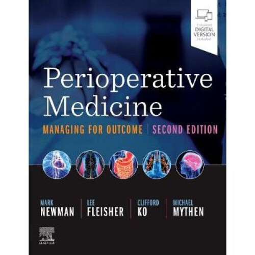 Perioperative Medicine Managing for Outcome