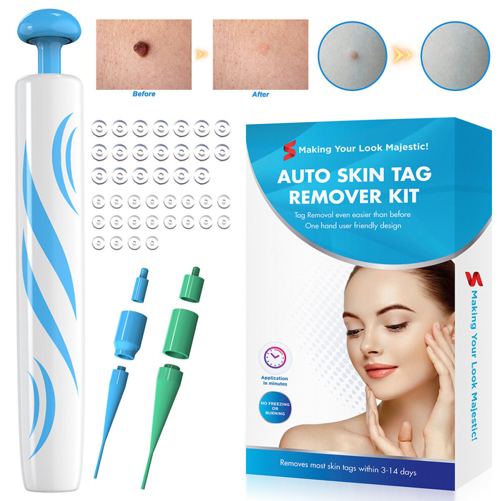Homeasist Blue Painless Micro Auto Skin Tag Mole Wart Removal Rubber Bands Kit Skin Cleansing