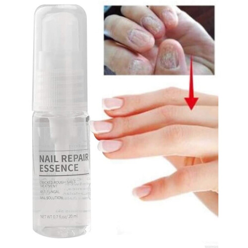Toenail Repair Nail Care Liquid Spray 20Ml forDiscoloration Brittle