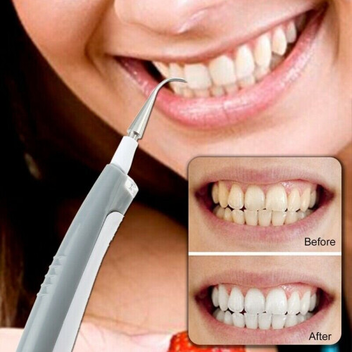 Electric Ultrasonic Dental Scaler Tooth Calculus Remover Cleaner