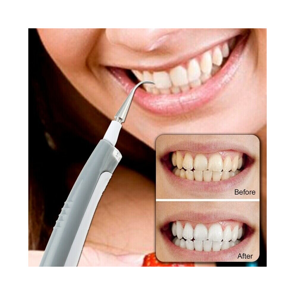 Electric Ultrasonic Dental Scaler Tooth Calculus Remover Cleaner