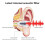 Sleeping Earplugs,Liquid Silicone Rubber 2 Pairs Different Sizes 4