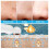 Electric Vacuum Blackhead Remover A e Blackhead remover 5