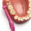 Tepe Tepe Angled 0.4mm Pink Interdental Brushes - Pack of 6 2